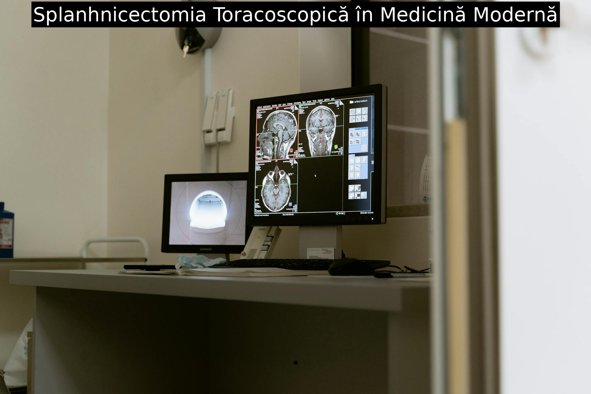 Splanhnicectomia Toracoscopică în Medicină Modernă