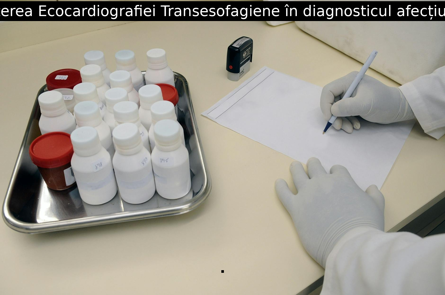 Descoperă puterea Ecocardiografiei Transesofagiene în diagnosticul afecțiunilor cardiace!