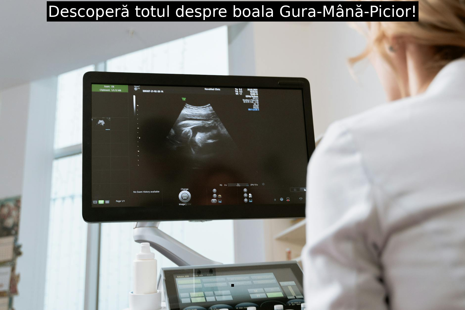Descoperă totul despre boala Gura-Mână-Picior!