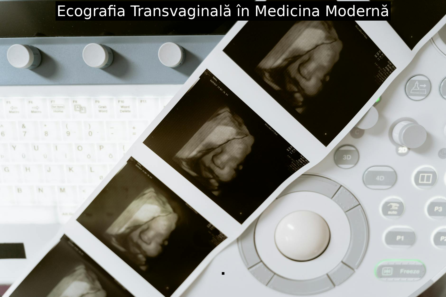 Ecografia Transvaginală în Medicina Modernă