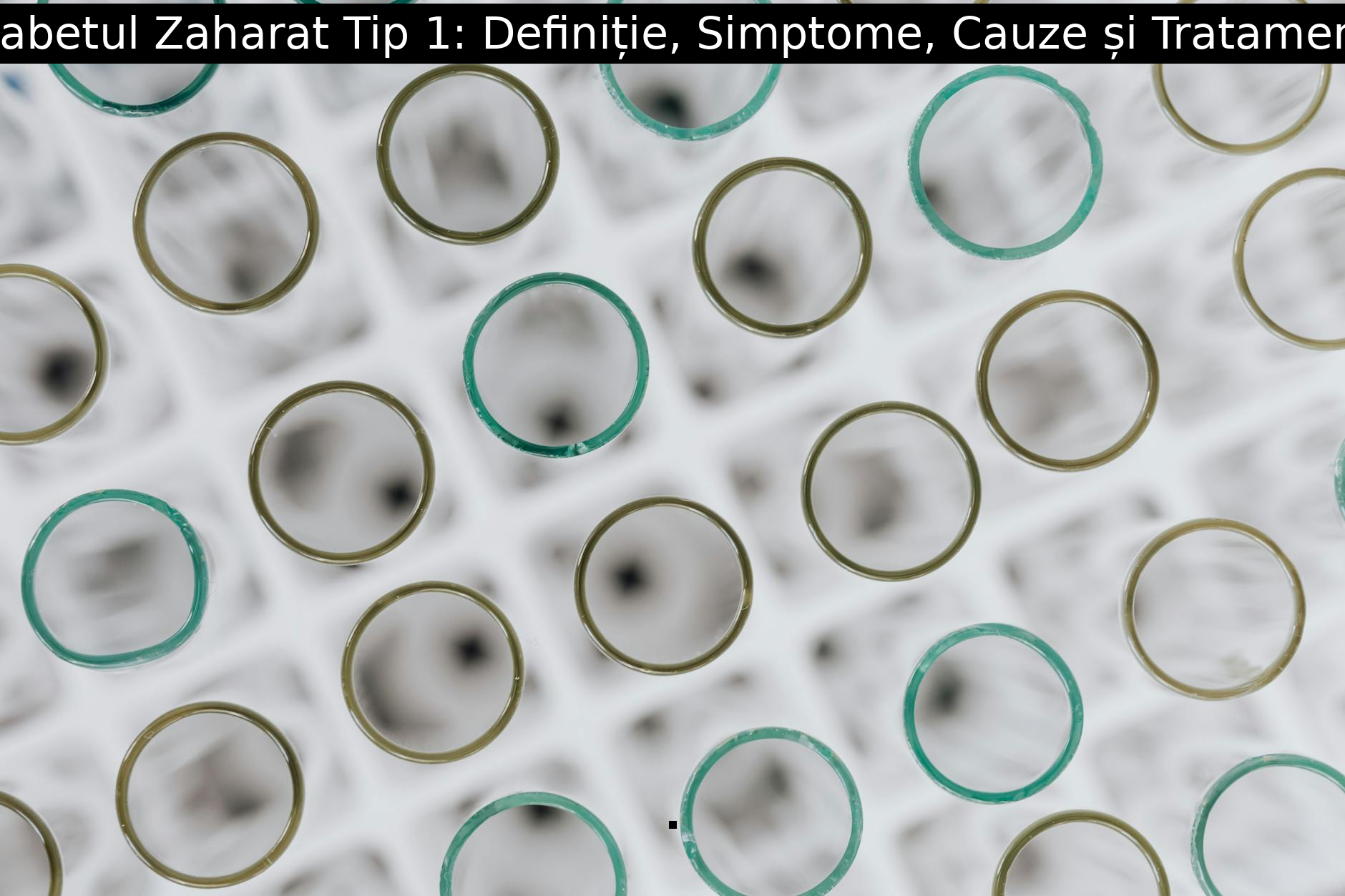 Diabetul Zaharat Tip 1: Definiție, Simptome, Cauze și Tratament.