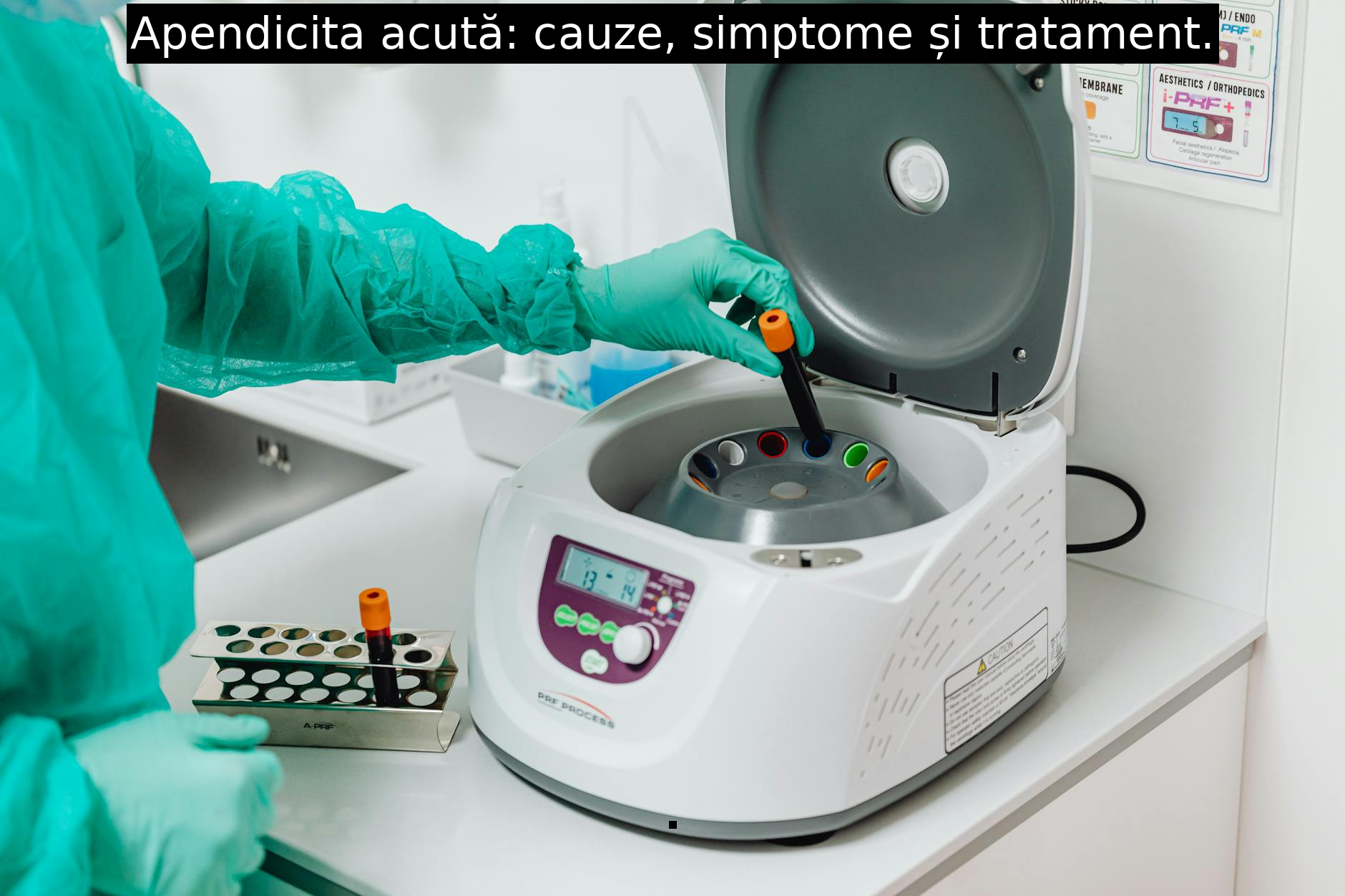 Apendicita acută: cauze, simptome și tratament.