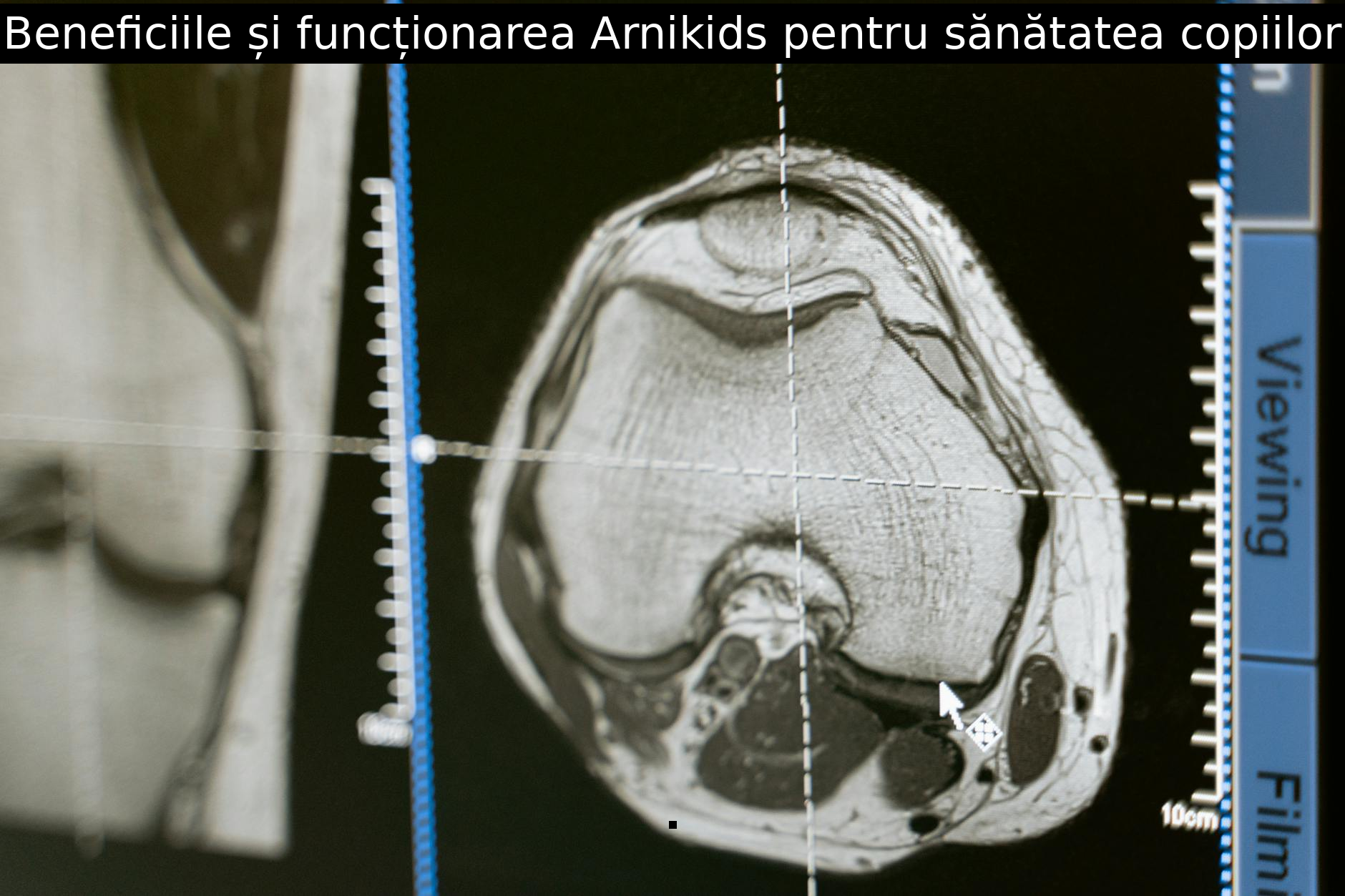 Beneficiile și funcționarea Arnikids pentru sănătatea copiilor