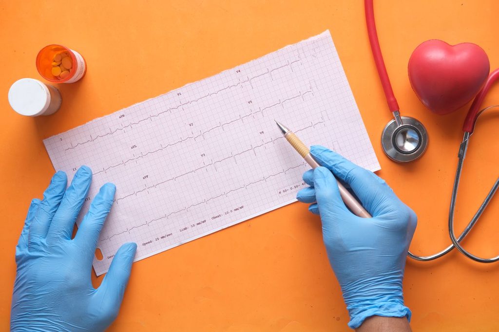 Afecţiuni cardiologice mai puţin cunoscute, diagnosticate în cabinetul de cardiologie